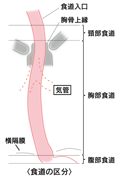 食道がんとは